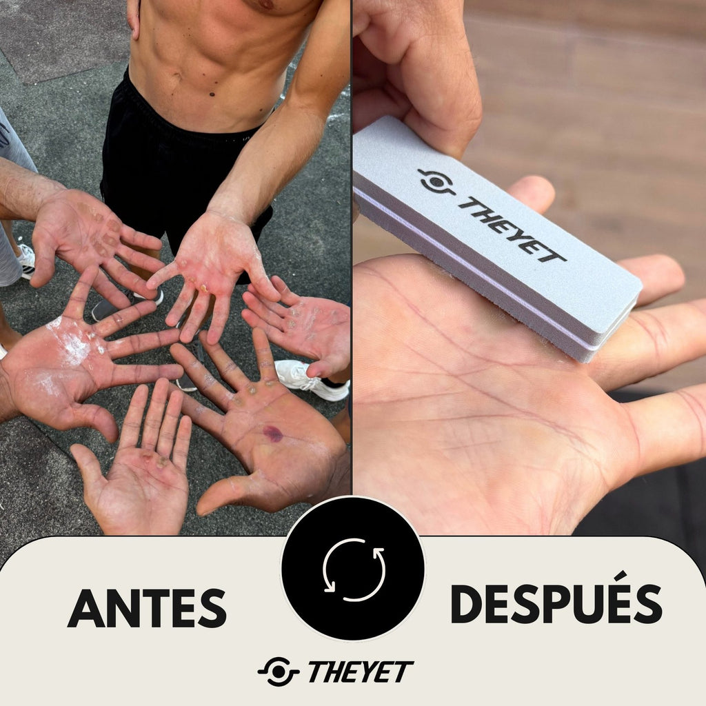 Lima de Callos (Pack 20)